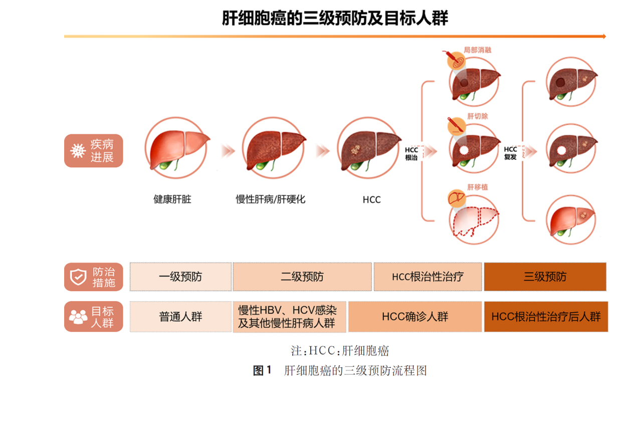 原發(fā)性肝癌三級預(yù)防共識（2022年版）指出復方鱉甲軟肝片有助于降低肝癌復發(fā)風險