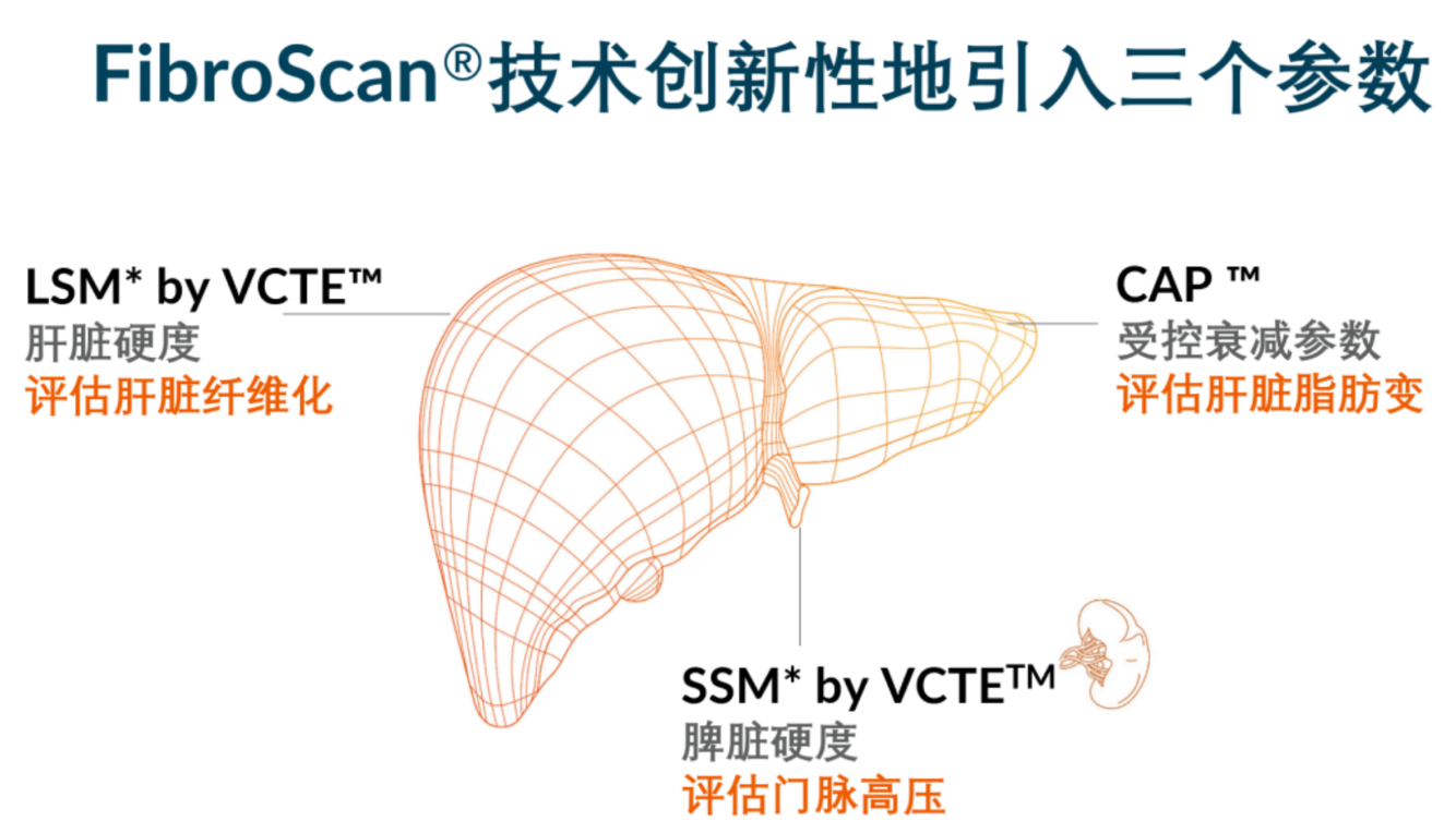 喜訊！FDA擴(kuò)大了FibroScan?在肝臟綜合管理中的應(yīng)用范圍