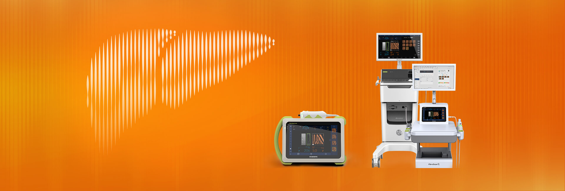 FibroScan?