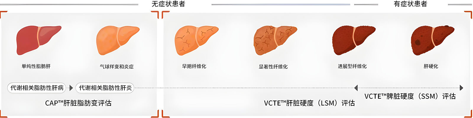 FibroScan?兩大核心技術(shù)
